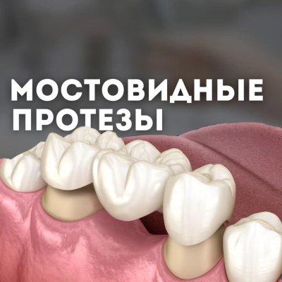 фото голливуд дентал